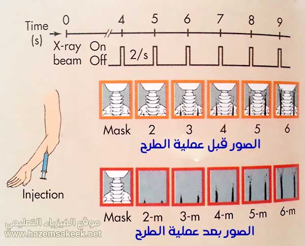 Fluoroscopy كيف يعمل التصوير الفلوروسكوبي