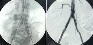 Fluoroscopy كيف يعمل التصوير الفلوروسكوبي