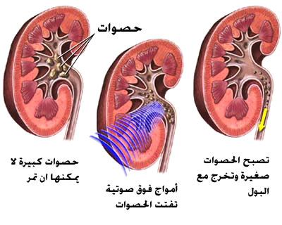 كيف سيعمل الروبوت النانوي