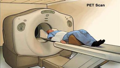 المسح الطبقي بواسطة انبعاث البوزيترونات PET