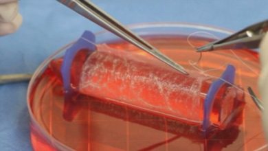 هندسة النسج الحية Tissue Engineering