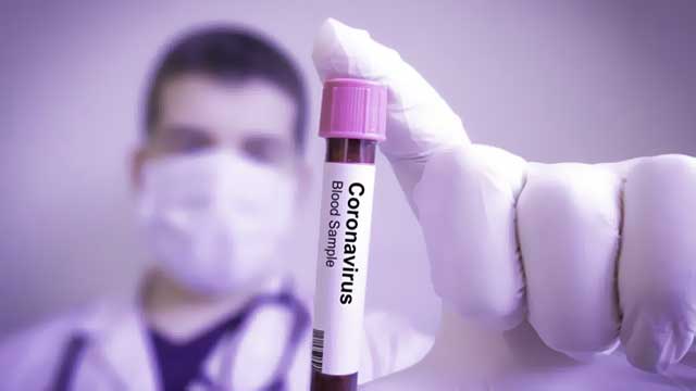 متى سيكون العلاج من اصابة فيروس كورونا جاهزًا وفاعلا؟